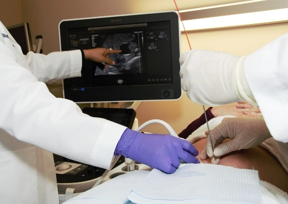 close up image of an ultrasound tech observing a monitor