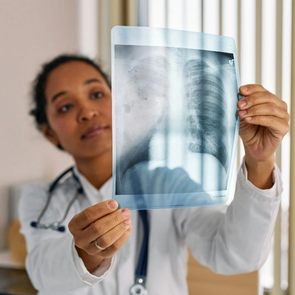 A doctor examining an x-ray of a patient's lungs. 