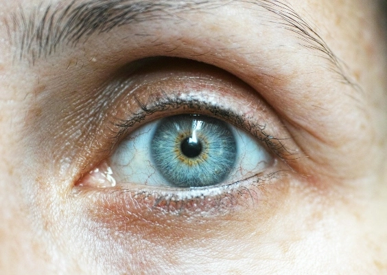 Closeup of a person's eye.